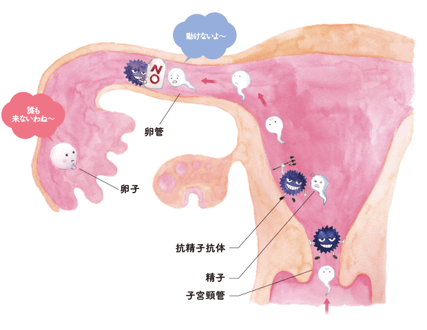 抗精子結合抗体
